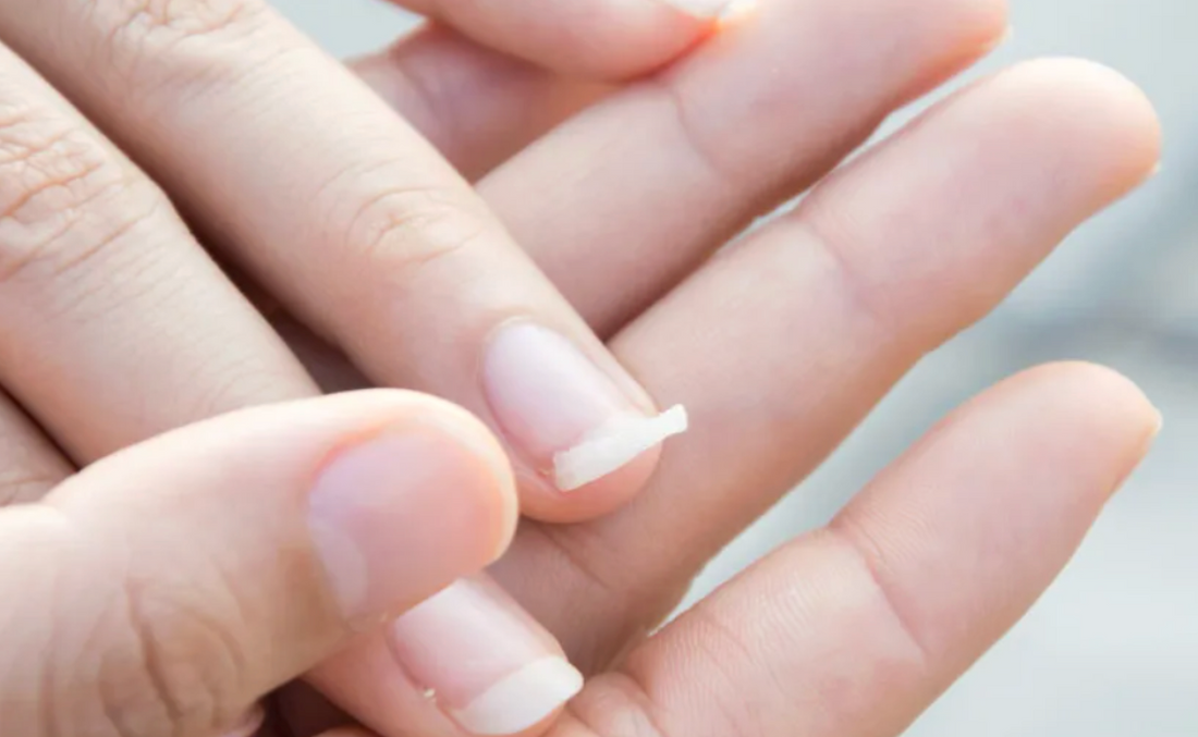 Why Are Your Nails Soft? The Hidden Signs Your Body Might Be Sending