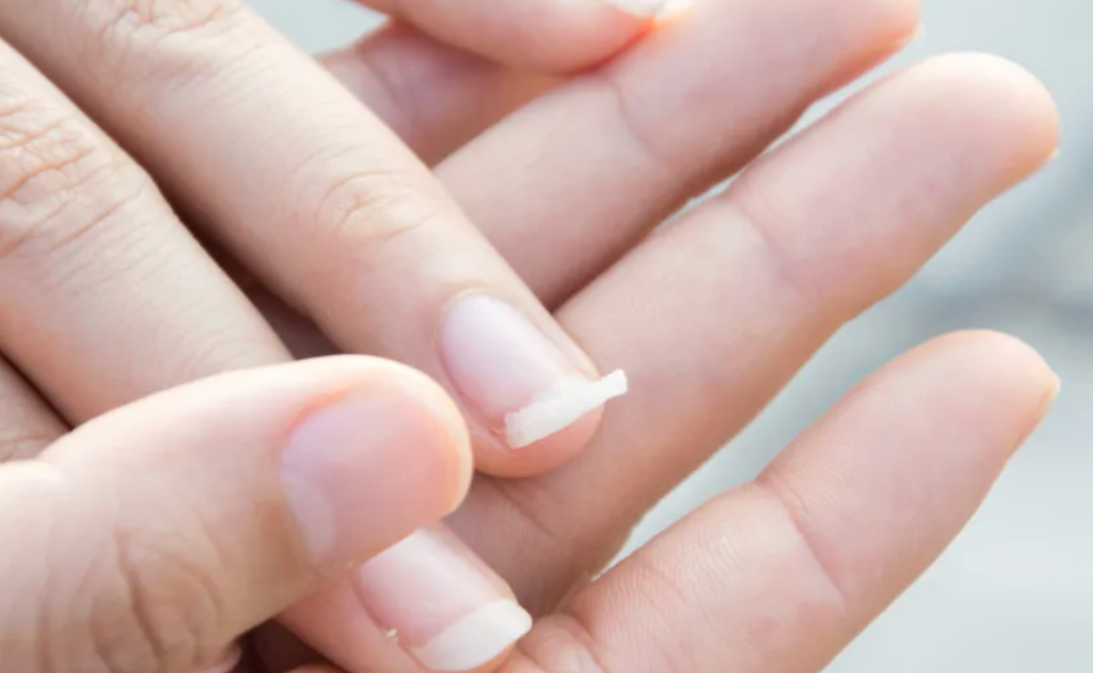 Why Are Your Nails Soft? The Hidden Signs Your Body Might Be Sending