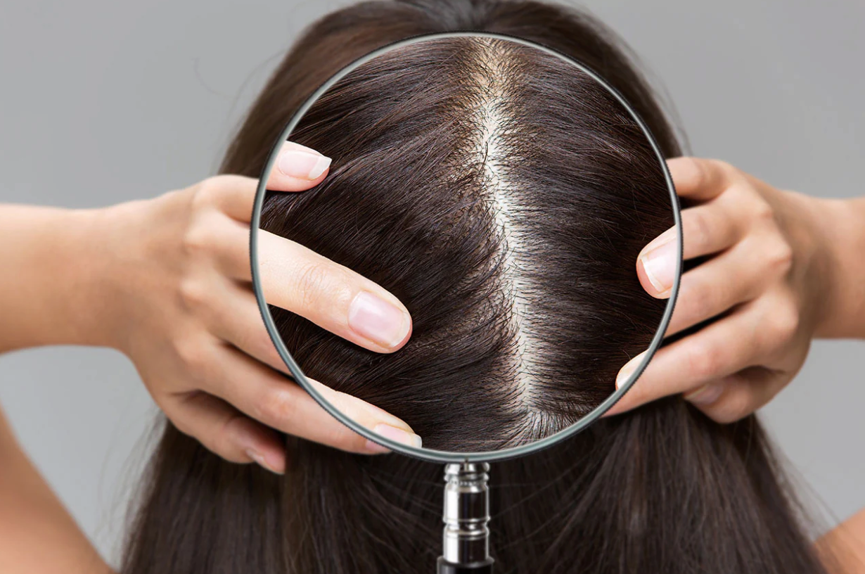 Why Scalp Care Is the Foundation of Healthy Hair